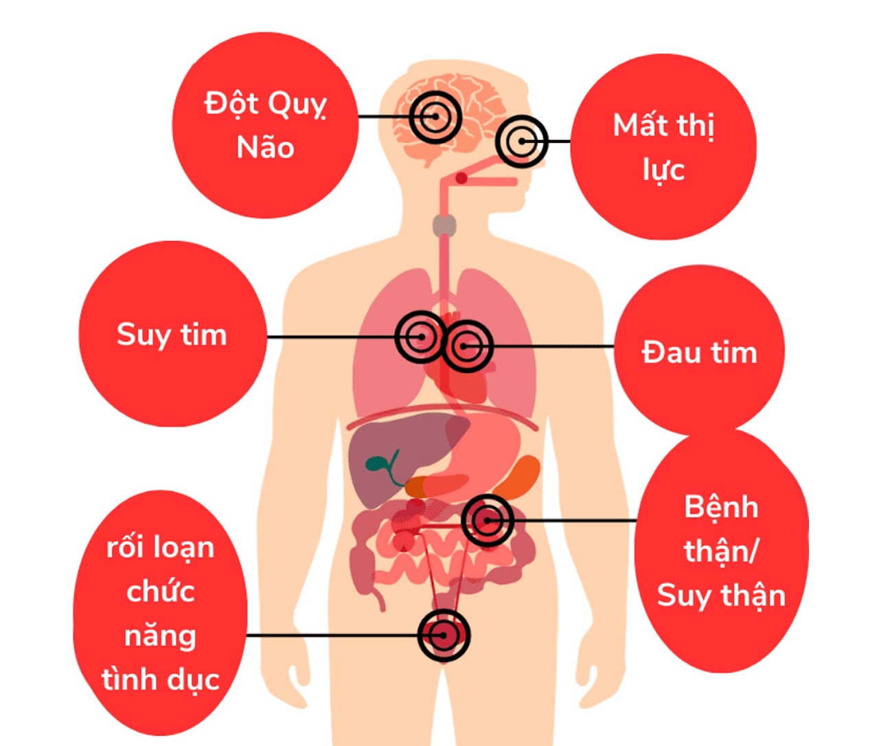 Tăng huyết áp kẻ giết người thầm lặng